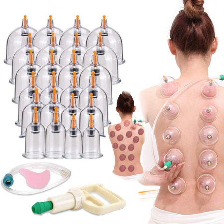 traditional Chinese vacuum cupping therapy set